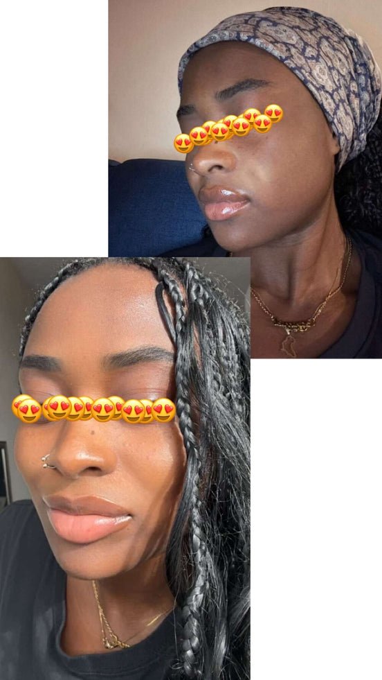 3-in-1 serum with hyaluronic acid, niacinamide, and bee pollen
