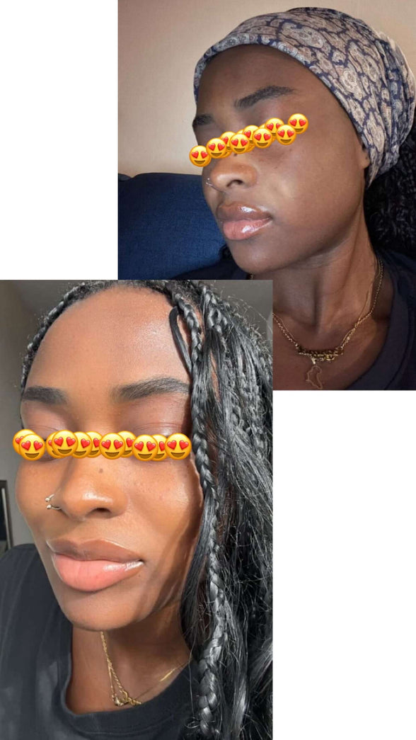 3-in-1 serum with hyaluronic acid, niacinamide, and bee pollen